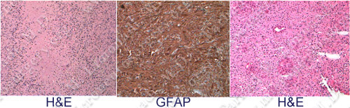 Case 4 Image 7