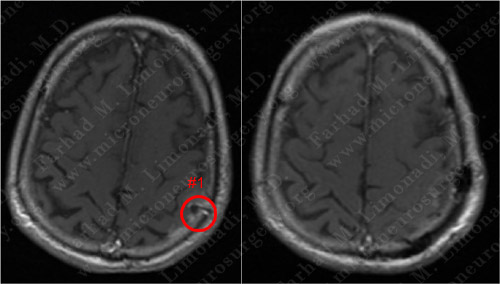 Case 4 Image 8