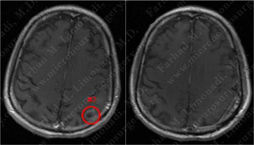 Case 4 Image 9