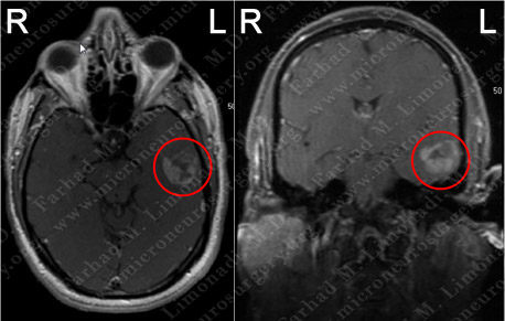 Case 5 Image 1