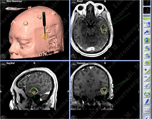 Case 5 Image 2