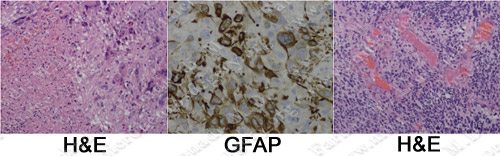 Case 5 Image 4