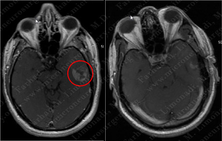 Case 5 Image 5