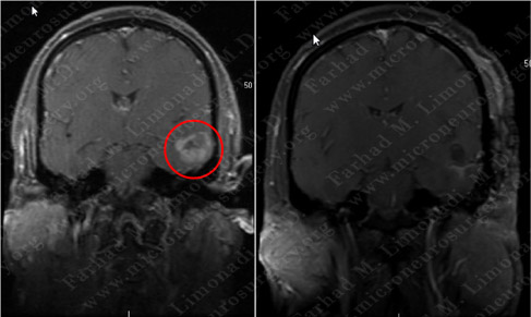 Case 5 Image 6