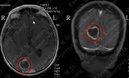 Case 8 Image 1