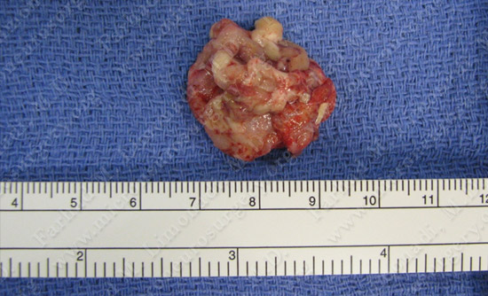 Case 8 Image 3
