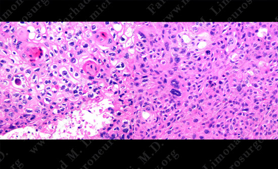 Case 8 Image 4