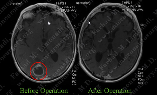 Case 8 Image 6