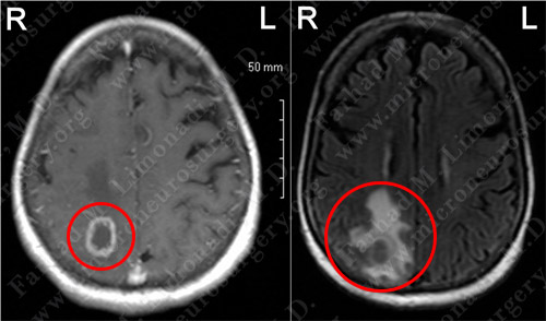 Case 6 Image 1