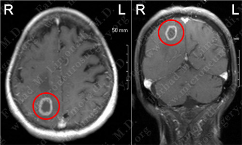 Case 6 Image 2