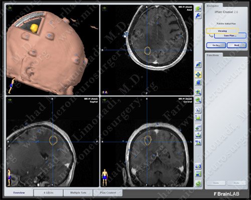 Case 6 Image 3