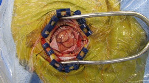 Case 6 Image 4
