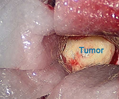 Case 6 Image 5