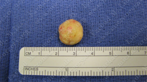 Case 6 Image 6