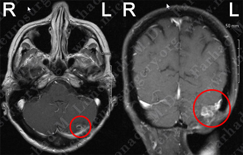 Case 7 Image 1