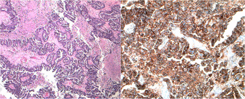 Case 7 Image 3
