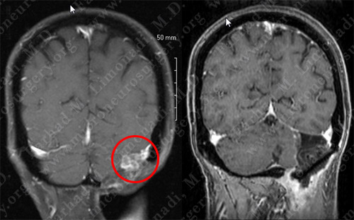 Case 7 Image 5