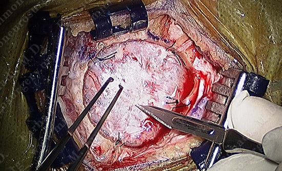 metastatic case10 img2