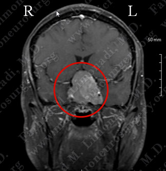 Case 2 Image 1