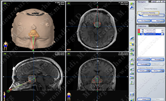 Case 2 Image 2