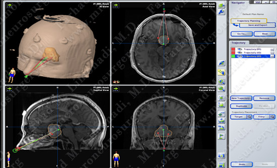 Case 2 Image 3