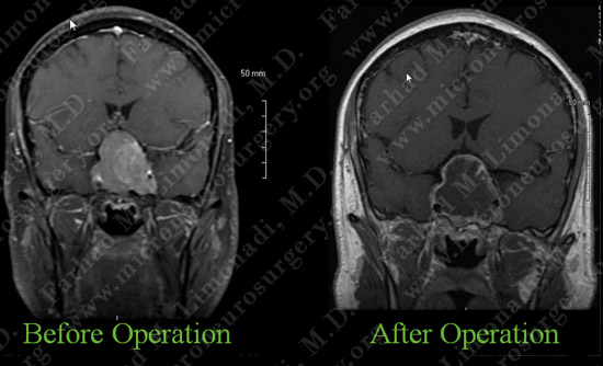 Case 2 Image 4