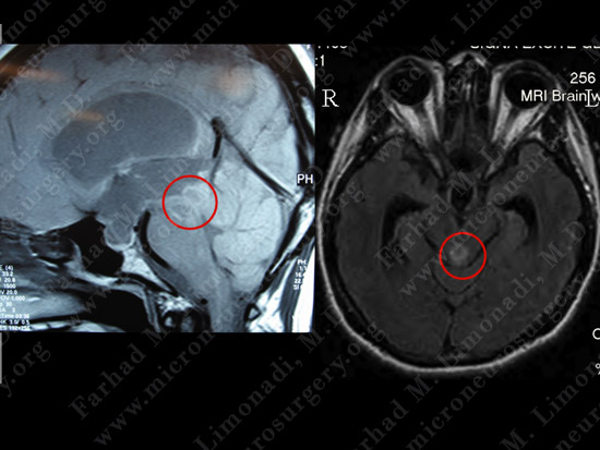 stem_case2_img1