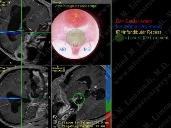 stem_case2_img10