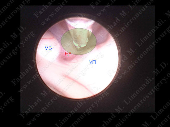 stem_case2_img11