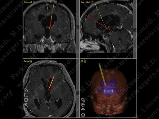 stem_case2_img12