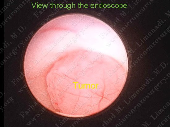 stem_case2_img13