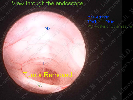 stem_case2_img14