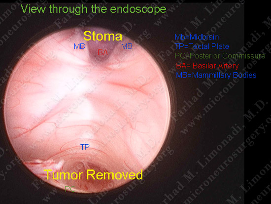 stem_case2_img15