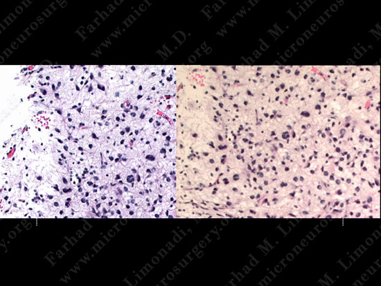 stem_case2_img16