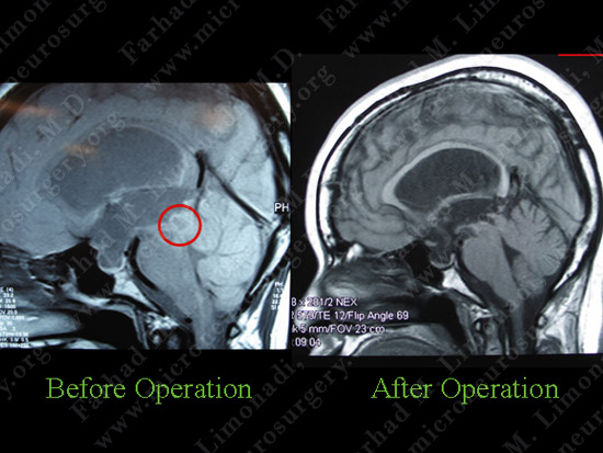 stem_case2_img17