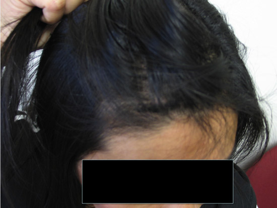 stem_case2_img18