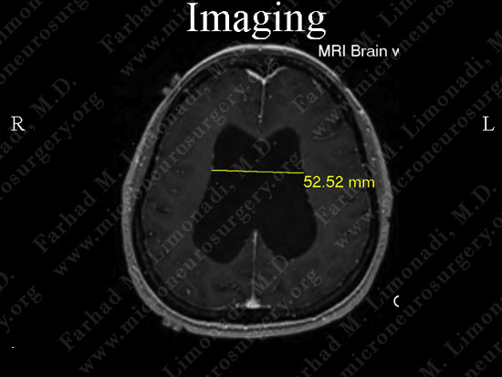 stem_case2_img2