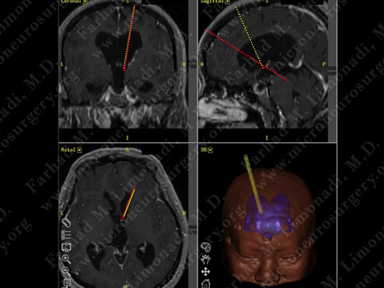 stem_case2_img3