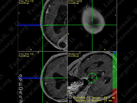 stem_case2_img7
