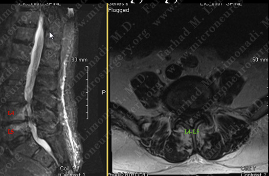 Case 2 Image 1