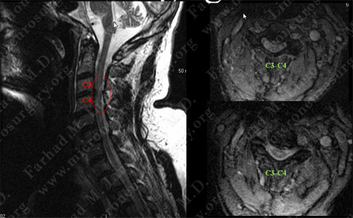 Case 2 Image 1