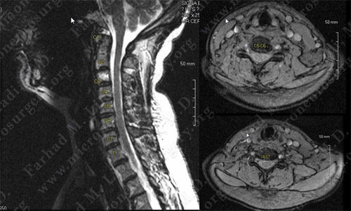 Case 3 Image 1