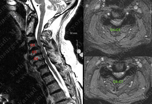 Case 4 Image 1