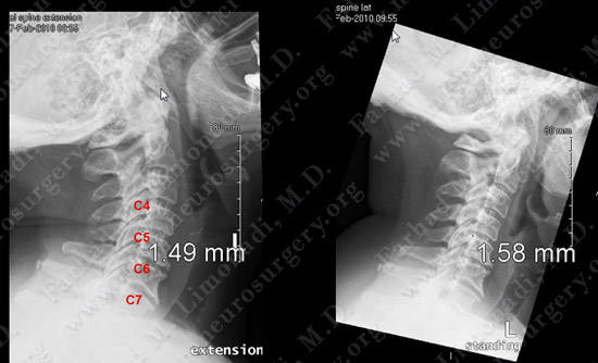 Case 5 Image 1