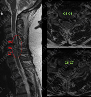 Case 6 Image 1