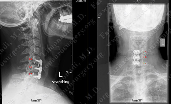 Case 6 Image 2