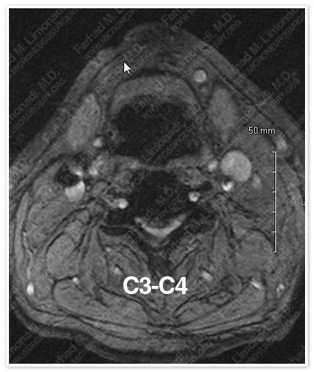 Case 1 Image 2