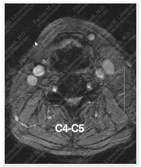 Case 1 Image 3