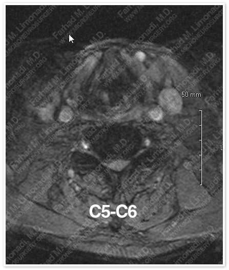 Case 1 Image 4