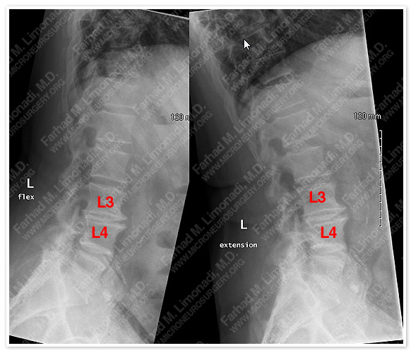 Case 1 Image 1